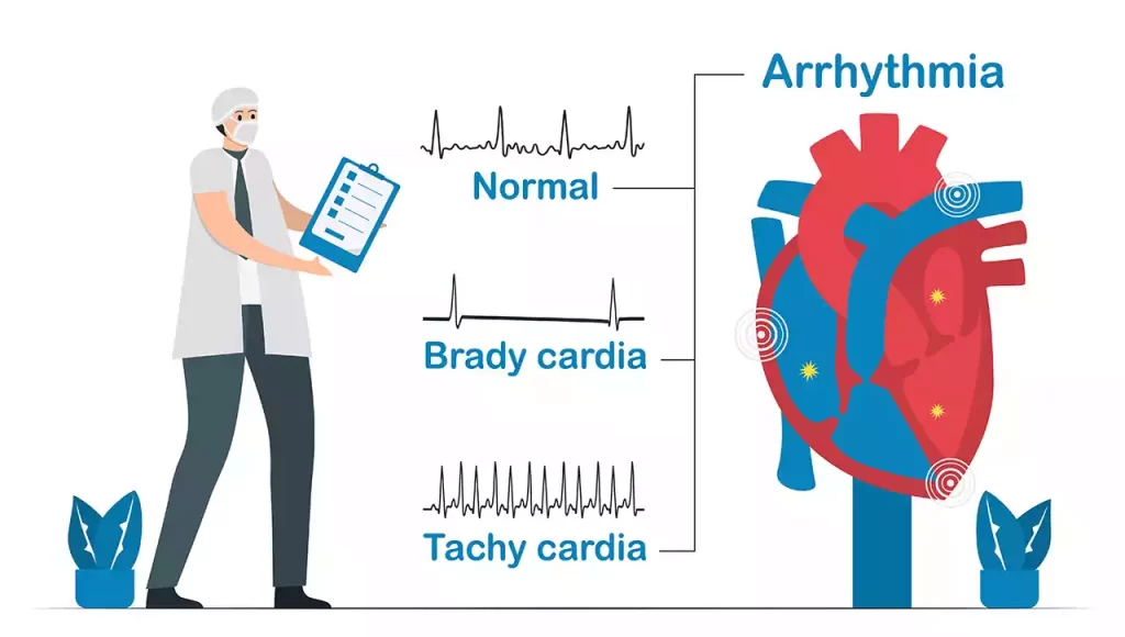 l carnitine and heart palpitations Your Heart: How to Keep the Rhythm كريم تفتيح احترافي Flavor:Apple Cold and Flu IV
